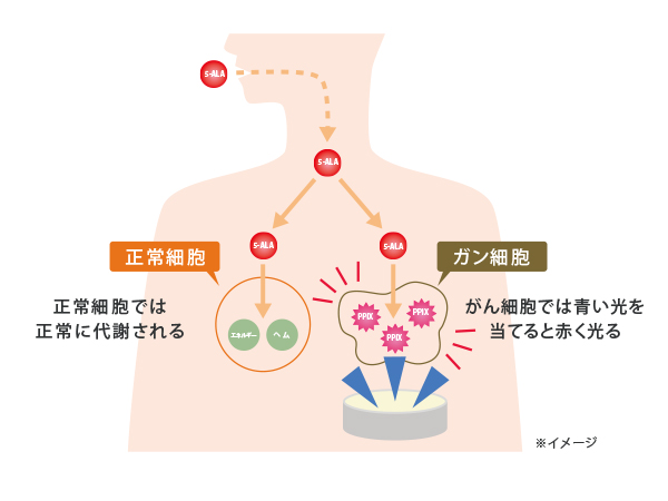 意外と知られていない5-ALAの可能性
