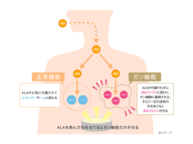 不思議な特徴を持つALA